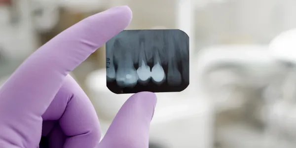 Cosmetic Dentistry
